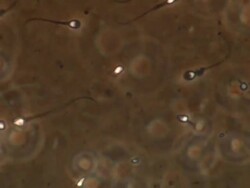 Human sperm, lots swimming around, red brown background Stock Footage