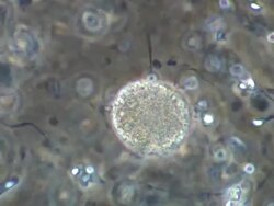 Human sperm around egg-like sphere Stock Footage