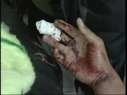 AP pix of hospital, intv with injured man, people fear aftershocks Instructional Video