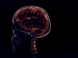 Medium Close Up push-in - A computer-generated surgical model highlights a cyst and cerebrospinal fluid inside a brain. Stock Footage