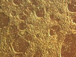 New Heart Muscle Patches Developed News Clip