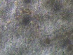 Phase Contrast view of Toad (Bufo bufo) tadpole tail capillary. Olympus BH-2 microscope, Olympus S-Plan 10x phase objective, NFK 5x photoeyepiece. Stock Footage