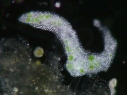 Dark Field view of Amoeba showing ingested algal cells Stock Footage