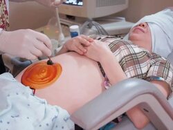 Apply betadine Stock Footage