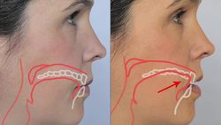 English Sounds - S [s] and Z [z] Consonants - How to make the S and Z Consonants Instructional Video