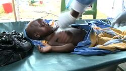 CLEAN : Hundreds infected by cholera in warn torn S Sudan: WHO News Clip