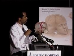 Doctor gives new detail of conjoined twins surgery News Clip