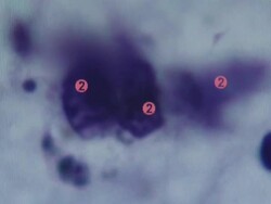 Lab Technicians Testing Mitochondria Samples News Clip