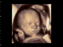 Foetus head up close, 4D ultrasound scan.. Stock Footage