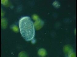 Freshwater ciliate protozoan with feeding cilia visible Stock Footage