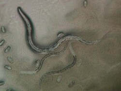 Various larval stages of Caenorhabditis elegans (C.elegans) with eggs Stock Footage