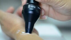 doppler ultrasound Stock Footage