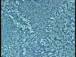 Tilt up microscopic view of Bacteria moving Stock Footage