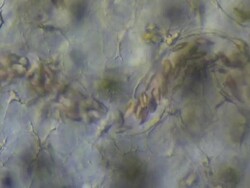 Differential Interference Contrast view of Toad (Bufo bufo) tadpole tail capillary network. Olympus BH-2 microscope, Olympus S-Plan 10x phase objective, NFK 5x photoeyepiece. Stock Footage