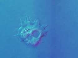 ECU T/L Shot of Amoeba is unicellular organism with constantly changing shape with moving forwards by sending out pseudopods which help it to crawl along surface and Diatoms are also moving / Newcastle Emlyn, Ceredigion, United Kingdom Stock Footage