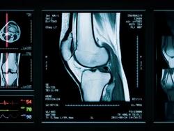 Knee MRI Scan. Top, front and lateral view. Blue. Stock Footage