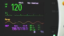 Vital signs monitor Stock Footage