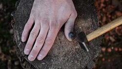 Bruised finger Stock Footage