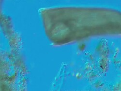 Ciliate (unidentified) moving around Stock Footage