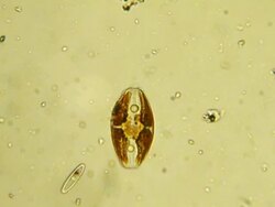 Micro organism: diatom Stock Footage