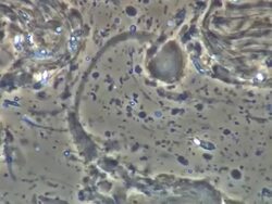 Human sperm swept along in ejaculate Stock Footage