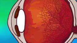 TED-Ed: What are those floaty things in your eye? - Michael Mauser Instructional Video