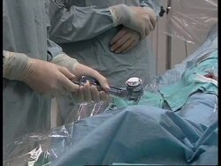 ISRAEL/USA: ALTERNATIVE OPERATION TO HEART BYPASS News Clip