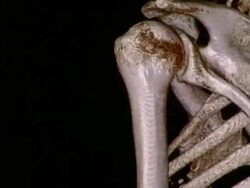 CU CT scan of ribcage and sternum / Vermont, USA Stock Footage