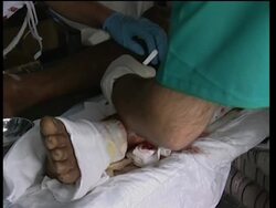 Australian mobile hospital treats injured News Clip