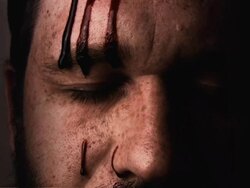 Bleeding Head Stock Footage