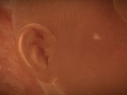 Male foetus in the womb. His hand and ear are seen in close-up, and he opens his eyes. This foetus is at full term, and is fully developed and ready for birth Stock Footage