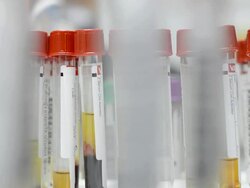 test tube Stock Footage