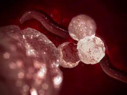 Close Up pan-right - White blood cells kill a Toxocara worm in a computer-generated animation. Stock Footage