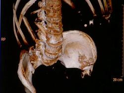 CU CT scan of human lower ribcage, spinal cord and pelvis / Vermont, USA Stock Footage