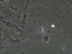 Human sperm, swimming Stock Footage