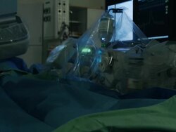 In radiology. Patient having her blood vessels x-rayed Stock Footage