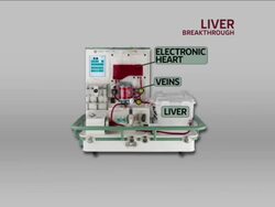 Medical breakthrough in Liver Transplants News Clip