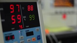 Patient monitor Stock Footage