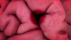 Study examines chronic traumatic encephalopathy threshold on boxers, MMA fighters Instructional Video