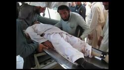 Injured in hospital, following market place bombing which killed dozens Instructional Video