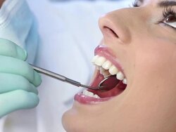 At the dentist Stock Footage