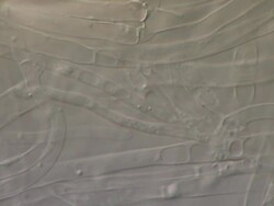 Dry rot fungus (Serpula lacrymans) hyphae, UK Stock Footage