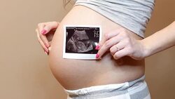 ultrasound image of a baby Stock Footage