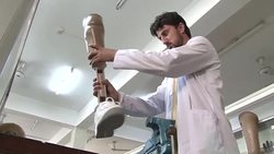 VOICED : Prosthetic limbs put Pakistani terror survivors together again News Clip