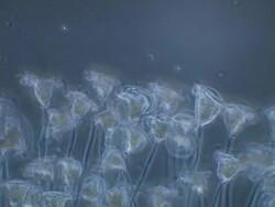 Vorticella sp. -though often found in clusters, each stalk is individually attached to the surface. Stock Footage