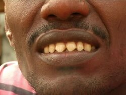 Man's pointed teeth Stock Footage