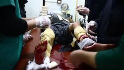 CLEAN : Syria: six people killed in missile on Douma (monitor) News Clip