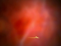 Plasma ECG Med Stock Footage