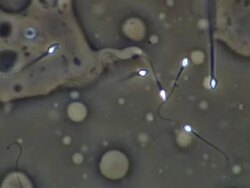 Human sperm swimming, close up, Phase contrast Stock Footage