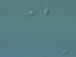 Human sperm swimming, Interference contrast Stock Footage